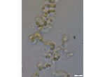 CT92 - cf. Nostoc