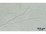 CT24 - Leptolyngbya sp.