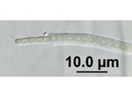 CT5 - cf. Leptolyngbya sp.