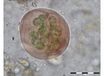 Asterocapsa