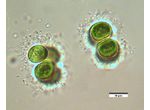 Limnococcus limneticus