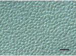 Cyanobacterium