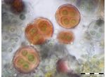 Gloeocapsa