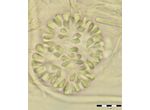 Gomphosphaeria