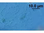 Lithococcus