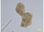 Microcystis ichthyoblabe