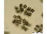 Microcystis viridis