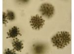 Radiocystis