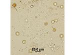 Rhabdoderma