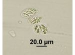 Rhabdogloea
