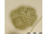 Woronichinia