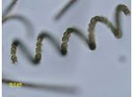 Dolichospermum crassum