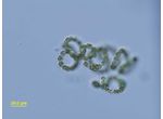 Dolichospermum flos-aquae