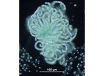 Dolichospermum lemmermannii