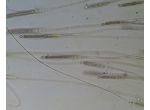 Gloeotrichia