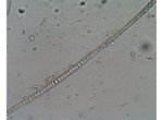 Nodularia