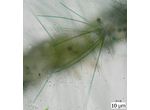 Heteroleibleinia