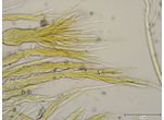 Schizothrix