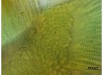 Stauromatonema