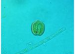 Phacus moniliatus var. suecicus