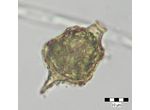 Strombomonas acuminata