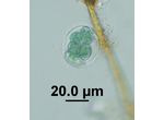 Glaucocystis