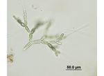 Batrachospermum gelatinosum