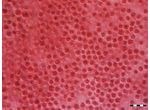 Porphyridium