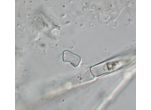 Actinotaenium geniculatum