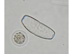 Actinotaenium infractum