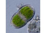Actinotaenium sp. 1