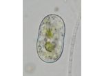 Actinotaenium trachypolum