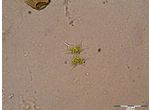 Arthrodesmus