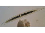 Closterium acerosum