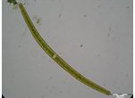 Closterium angustatum