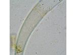 Closterium archerianum