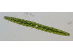 Closterium baillyanum