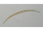 Closterium calosporum