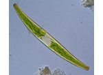 Closterium costatum