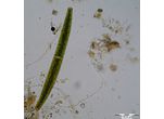 Closterium didymocotum