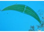 Closterium ehrenbergii