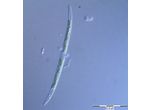 Closterium gracile