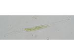 Closterium idiosporum