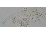 Closterium nematodes