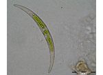 Closterium parvulum