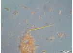 Closterium pronum