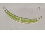 Closterium pseudopygmaeum