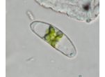 Closterium pusillum