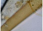 Closterium ralfsii