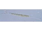 Closterium rostratum